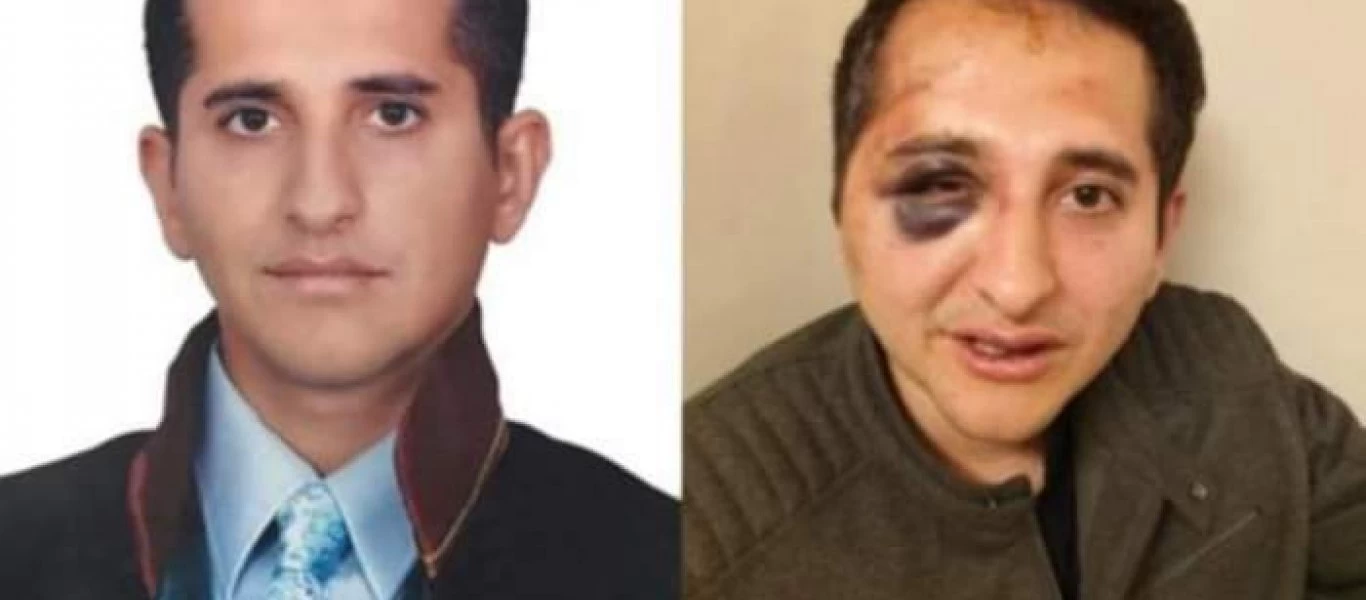 Τα αποτελέσματα της δράσης των σωματοφυλάκων του Ρ.Τ.Ερντογάν γιατί απλά ρώτησε για ποιον γίνονται όλα αυτά (βίντεο)